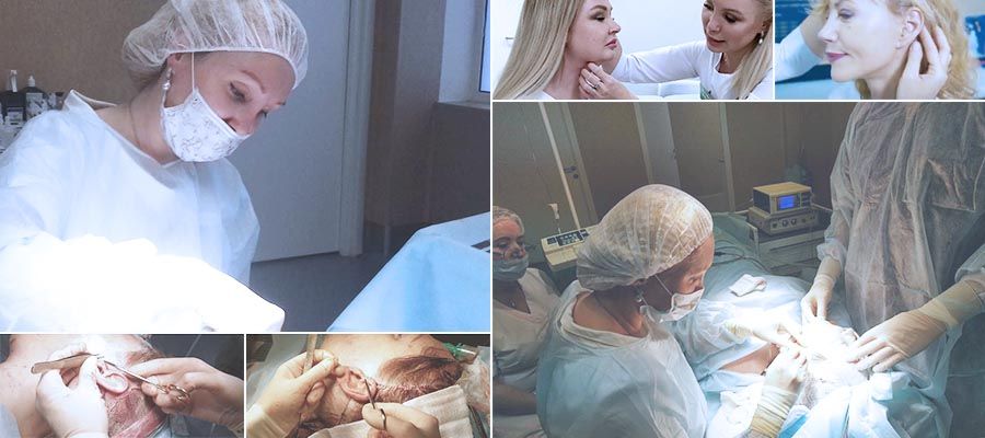 Подтяжка лица: как проходит операция